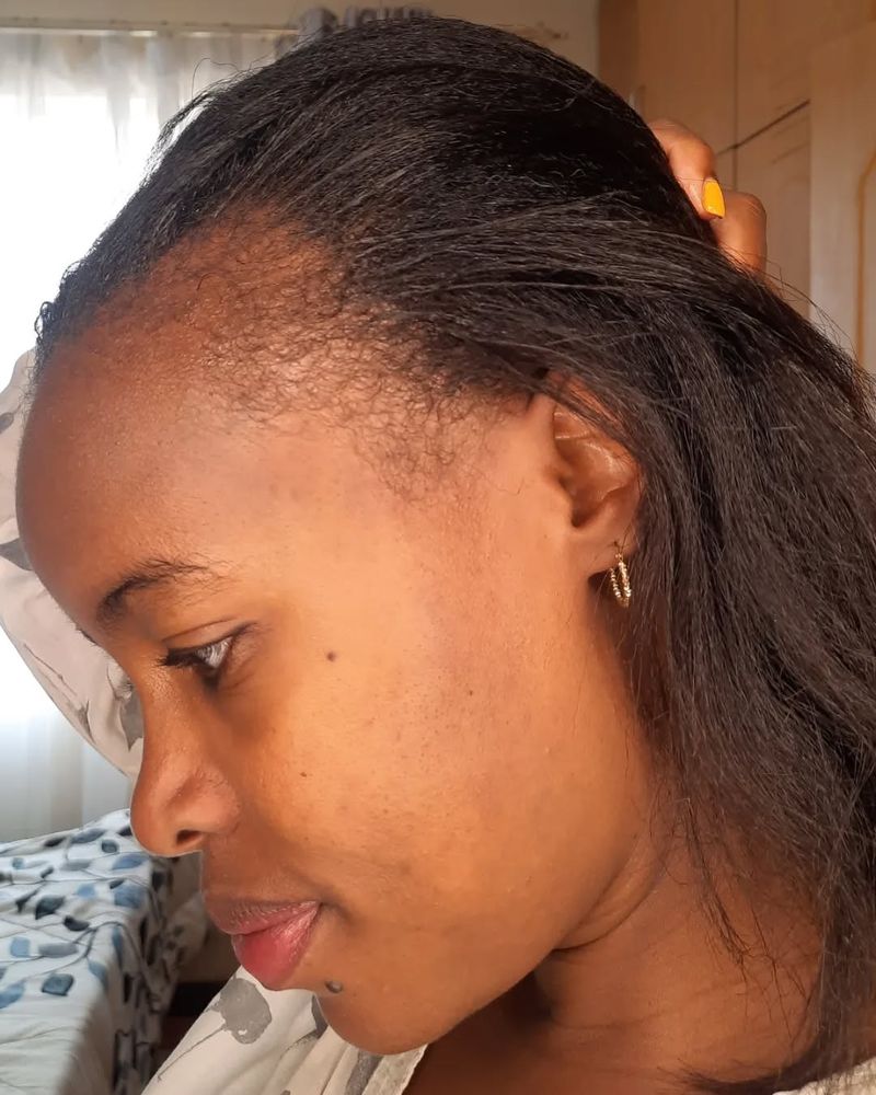 Avoid Tight Hairstyles