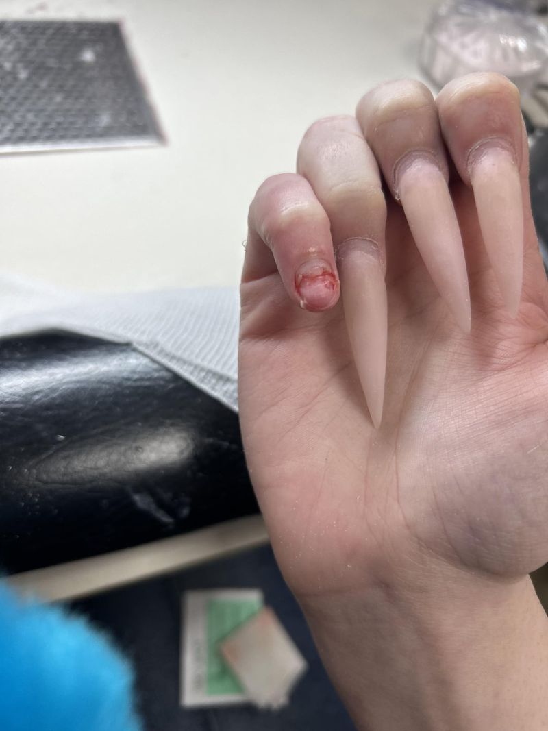 Exposing Nails to Hot Water Too Soon
