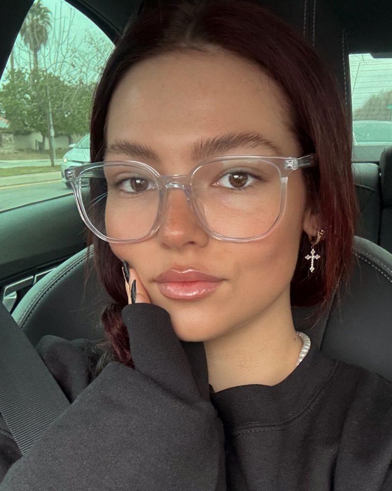 Enhancing a Prominent Cupid's Bow