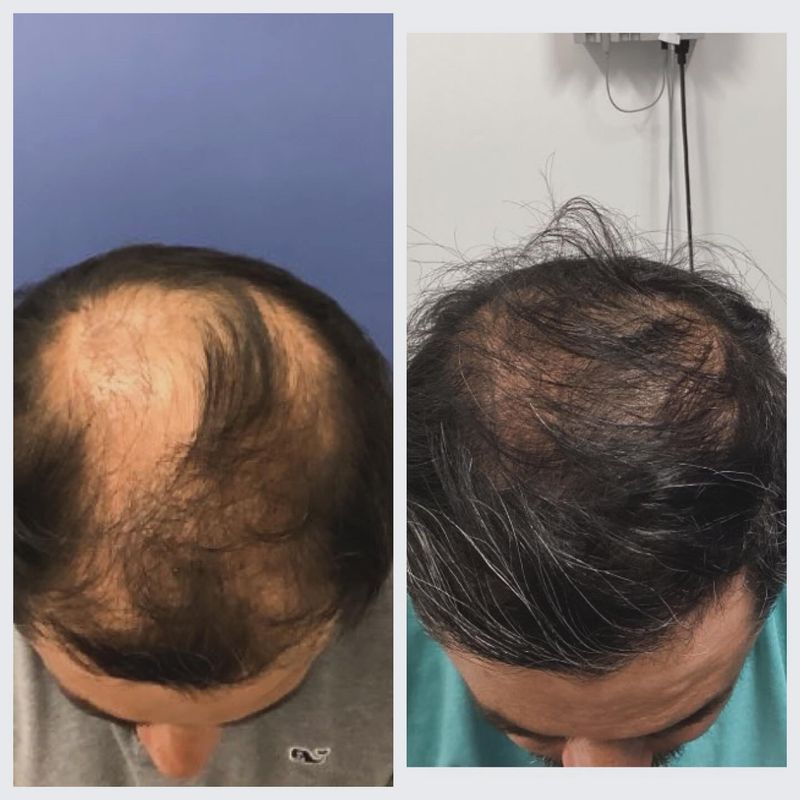 Explore Topical Treatments