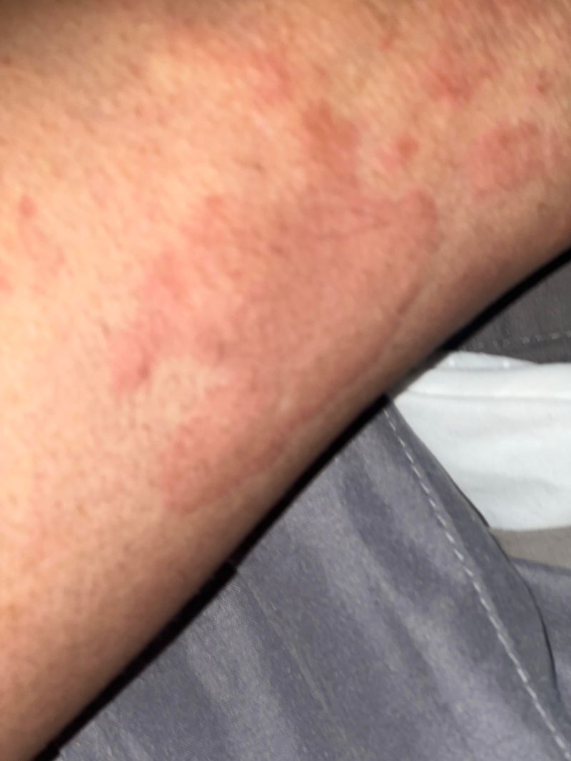 Chemical Residues Can Irritate Your Skin