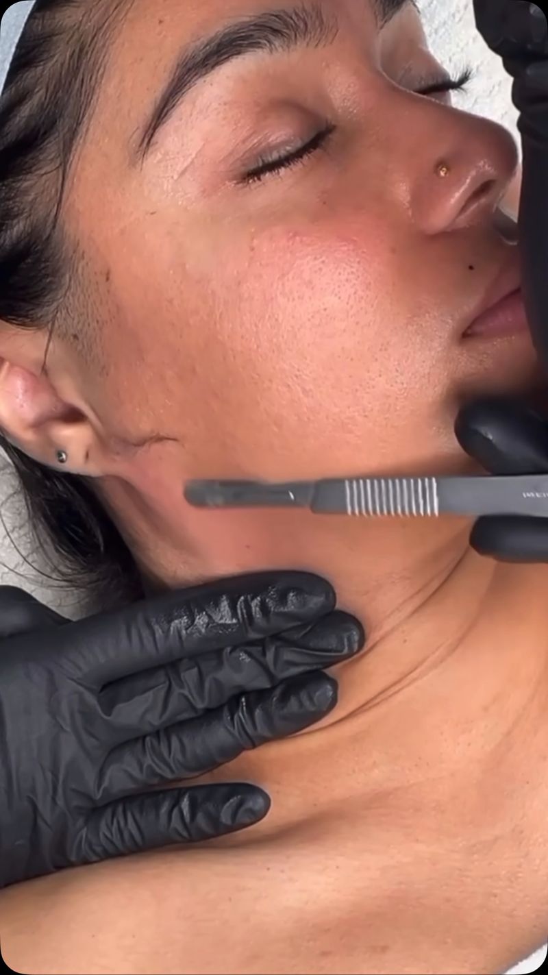 Exfoliation Is Too Harsh for Mature Skin