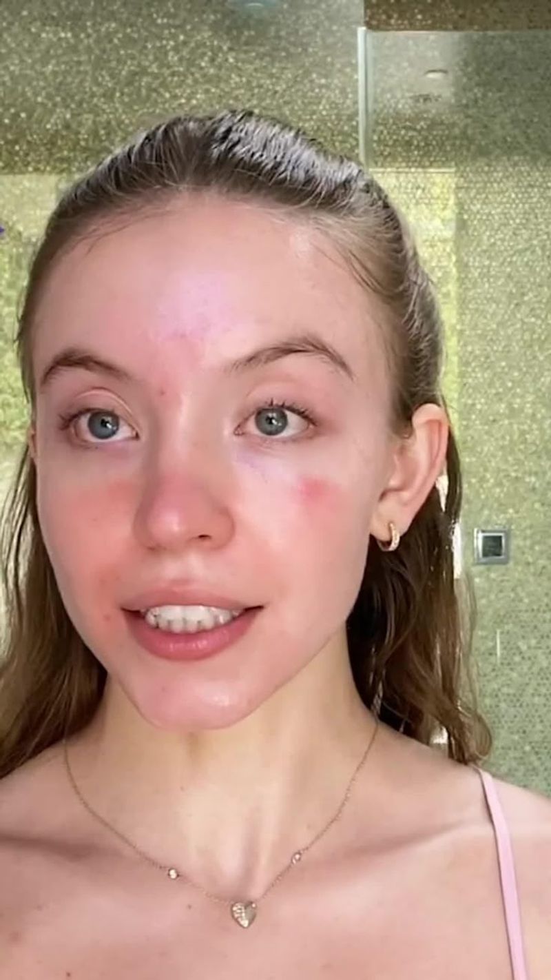 Toothpaste as Pimple Treatment