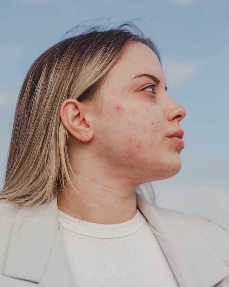 Picking and Prodding at Blemishes